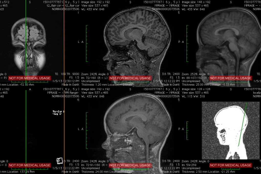 Artwork presentation of Haraldur Karlsson